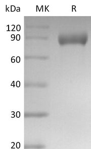 Recombinant Mouse Siglec-E (C-Fc)