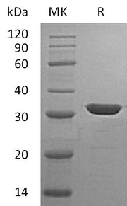 Recombinant Human Carbonic Anhydrase 13 (C-6His)
