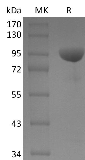 Recombinant Human EphB1 (C-Fc)