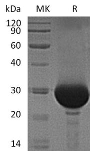Recombinant Human Carbonic Anhydrase 1 (C-6His)