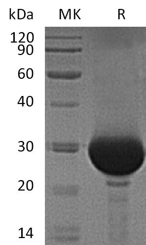 Recombinant Human Carbonic Anhydrase 1 (C-6His)