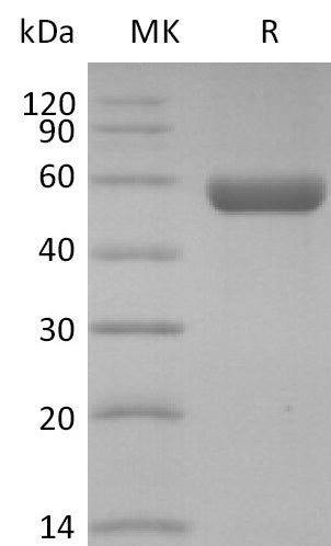 Recombinant Human HLA-A*0201 GP100 complex Protein (C-10His)