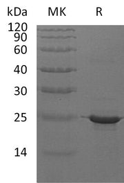Recombinant Human CRYAB (C-6His)