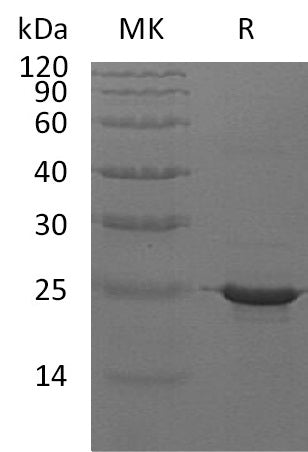 Recombinant Human CRYAB (C-6His)