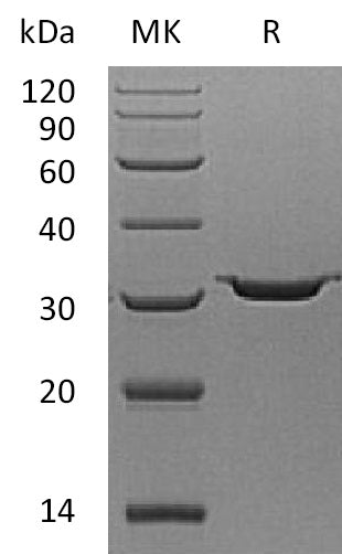 Recombinant Human Carbonic Anhydrase 7 (C-6His)