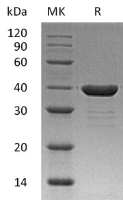 Recombinant Human Carbonic Anhydrase 8 (C-6His)