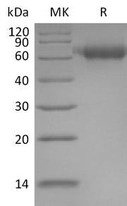 Recombinant Human IL-1RAcP (C-6His)