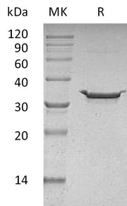 Recombinant Human Carbonic Anhydrase 5B (C-6His)