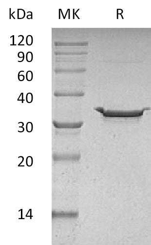 Recombinant Human Carbonic Anhydrase 5B (C-6His)