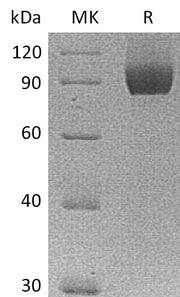 Recombinant Human Neuropilin-1 (C-6His)
