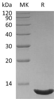 Recombinant Human CXCL12 (75AA)