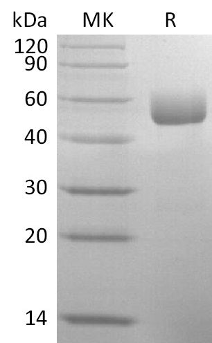 Recombinant Mouse Serpin A1a (C-6His, AAH11040.1)