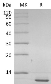 Recombinant Human CD9 (C-6His)