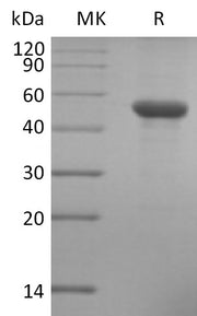Recombinant Human ILDR2 (C-6His)