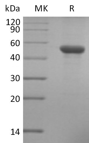 Recombinant Human ILDR2 (C-6His)