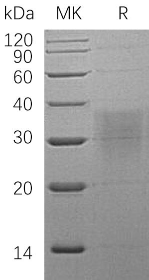 Recombinant Human BMPR2 (C-6His)