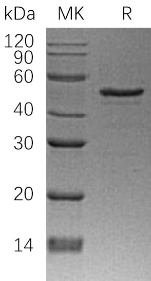 Recombinant Human NDRG1 (N-6His)