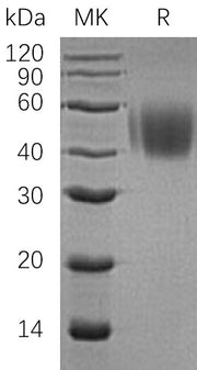 Recombinant Human SLAMF1 (C-6His)