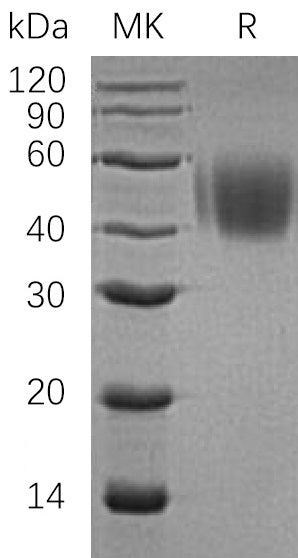 Recombinant Human SLAMF1 (C-6His)