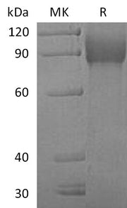 Recombinant Human VCAM-1 (C-6His)