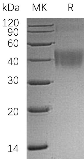 Recombinant Human CD200 (C-6His)