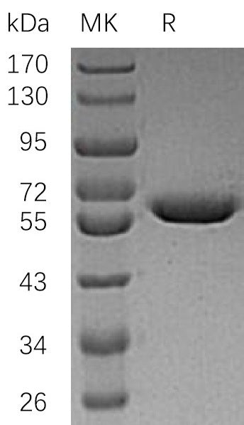 Recombinant Human ARSA (C-6His)