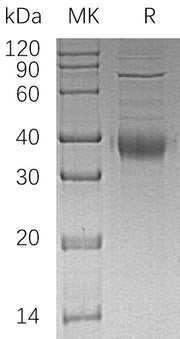 Recombinant Human KIR2DL4 (C-6His)