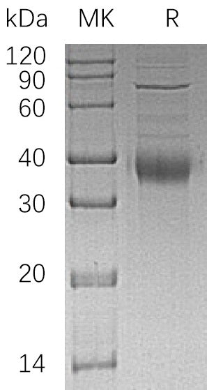 Recombinant Human KIR2DL4 (C-6His)