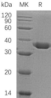 Recombinant Human Carbonic Anhydrase 10 (C-6His)