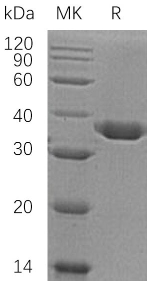 Recombinant Human Carbonic Anhydrase 10 (C-6His)