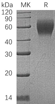 Recombinant Human CD200 R1 (C-6His)