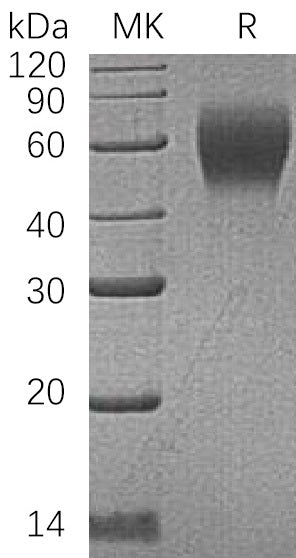 Recombinant Human CD200 R1 (C-6His)