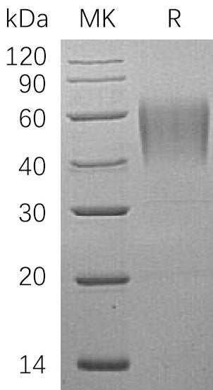 Recombinant Human ICAM-2 (C-6His)