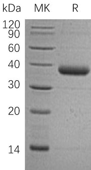 Recombinant Human C1QTNF1 (C-6His)