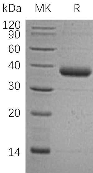 Recombinant Human C1QTNF1 (C-6His)