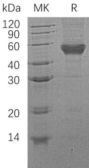 Recombinant Human CD14 (C-6His)