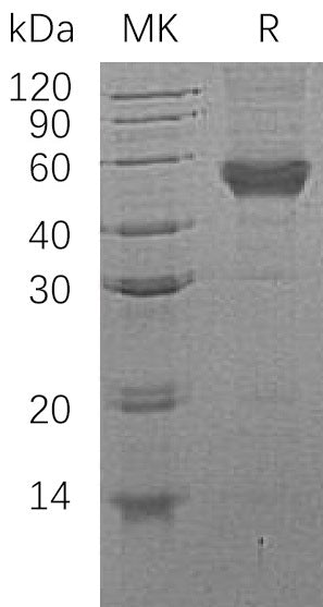Recombinant Human CD14 (C-6His)
