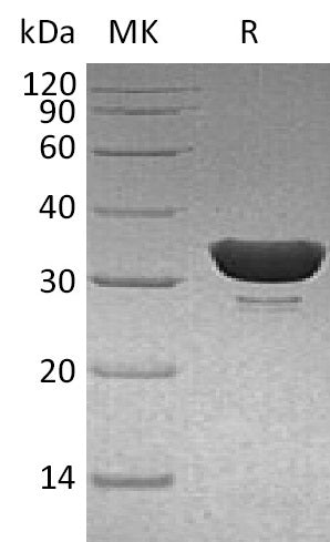 Recombinant Human DCUN1D1 (N-6His)