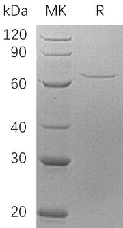 Recombinant Human AIF (N-6His)