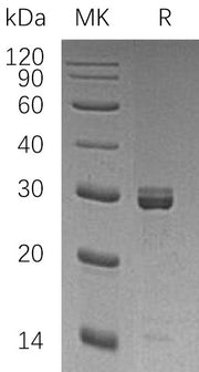 Recombinant Human EPT1 (N-GST)