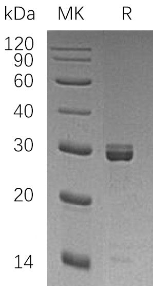 Recombinant Human EPT1 (N-GST)