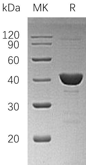 Recombinant Human UROD (N-6His)