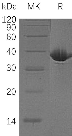 Recombinant Human MDH1 (C-6His)