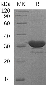 Recombinant Human HDHD2 (N-6His)