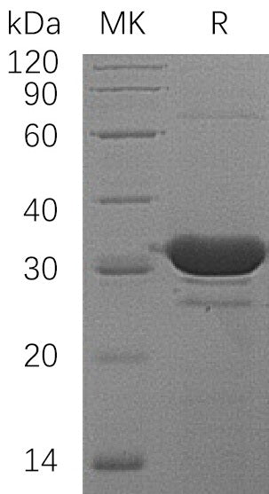 Recombinant Human HDHD2 (N-6His)