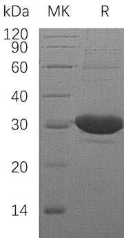 Recombinant Human DCXR (N-6His)