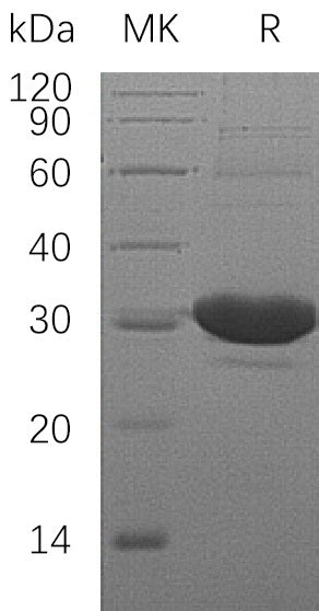 Recombinant Human DCXR (N-6His)