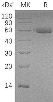 Recombinant Human HAO1 (N-Trx-6His)