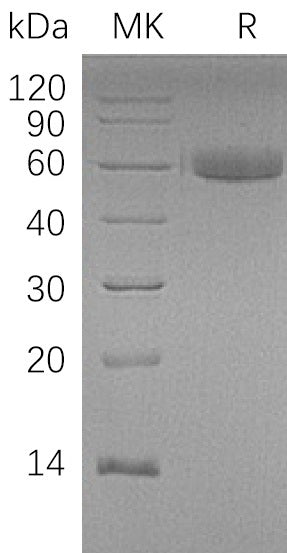 Recombinant Human HAO1 (N-Trx-6His)