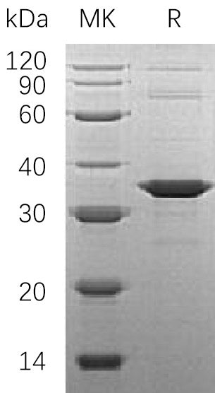 Recombinant Human SNAP-alpha (N-6His)